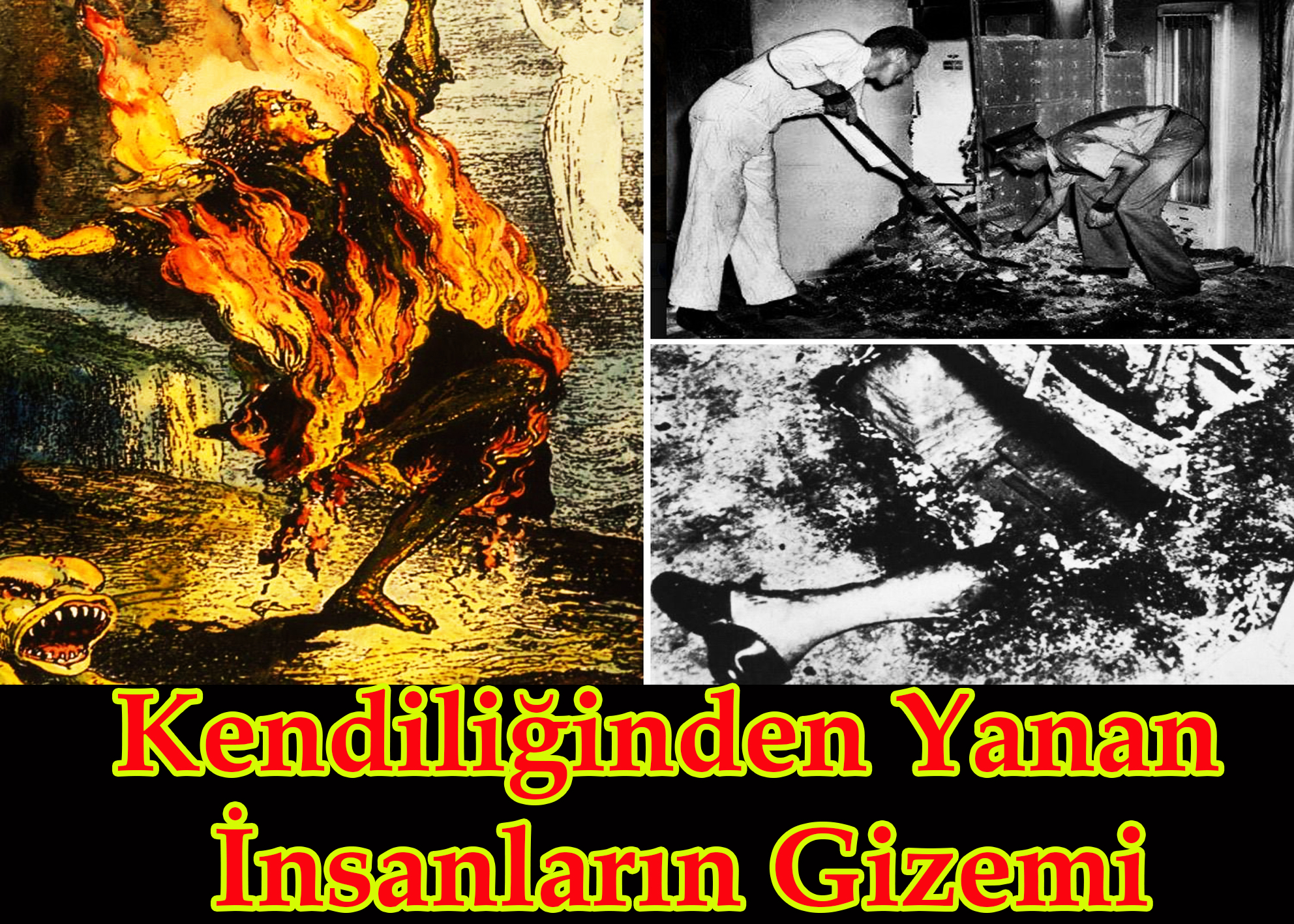Kendiliğinden Yanan İnsanların Gizemi